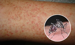 Bạn đã biết cách phòng, tránh sốt xuất huyết ?