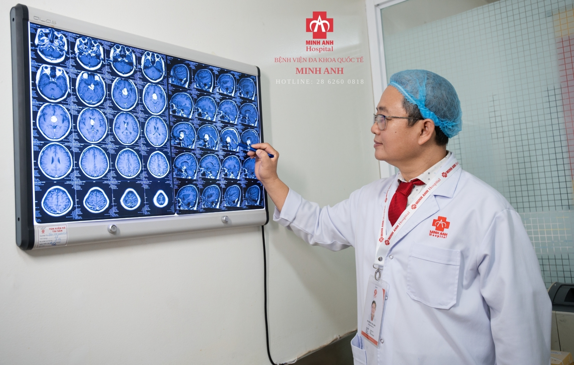 Phẫu thuật thành công khối u sọ hầu kích thước rất lớn ở vị trí đặc biệt nguy hiểm