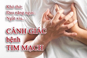 Có phải tôi bị tim mạch ?