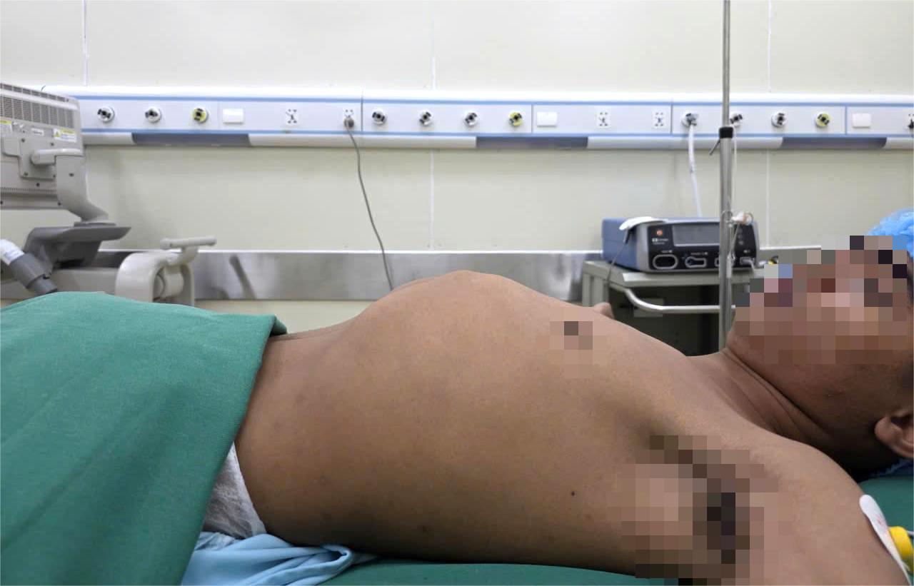 Ảnh: Bệnh nhân T.Y.T trước khi phẫu thuật