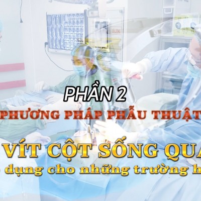Phần 2 Phẫu thuật bắt vít cột sống qua da